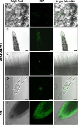 The PvNF-YA1 and PvNF-YB7 Subunits of the Heterotrimeric NF-Y Transcription Factor Influence Strain Preference in the Phaseolus vulgaris–Rhizobium etli Symbiosis